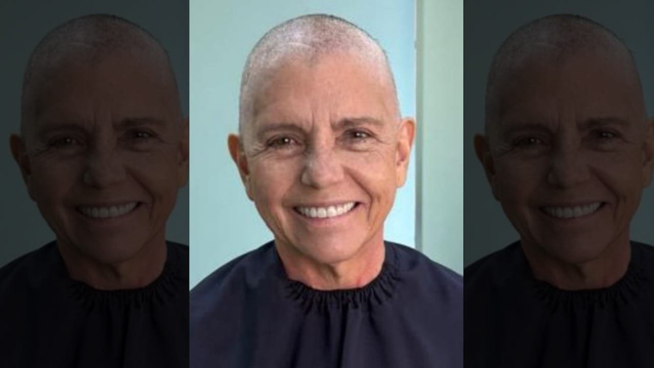 Filha de ex-presidente, deputada mostra cabeça raspada por causa de câncer