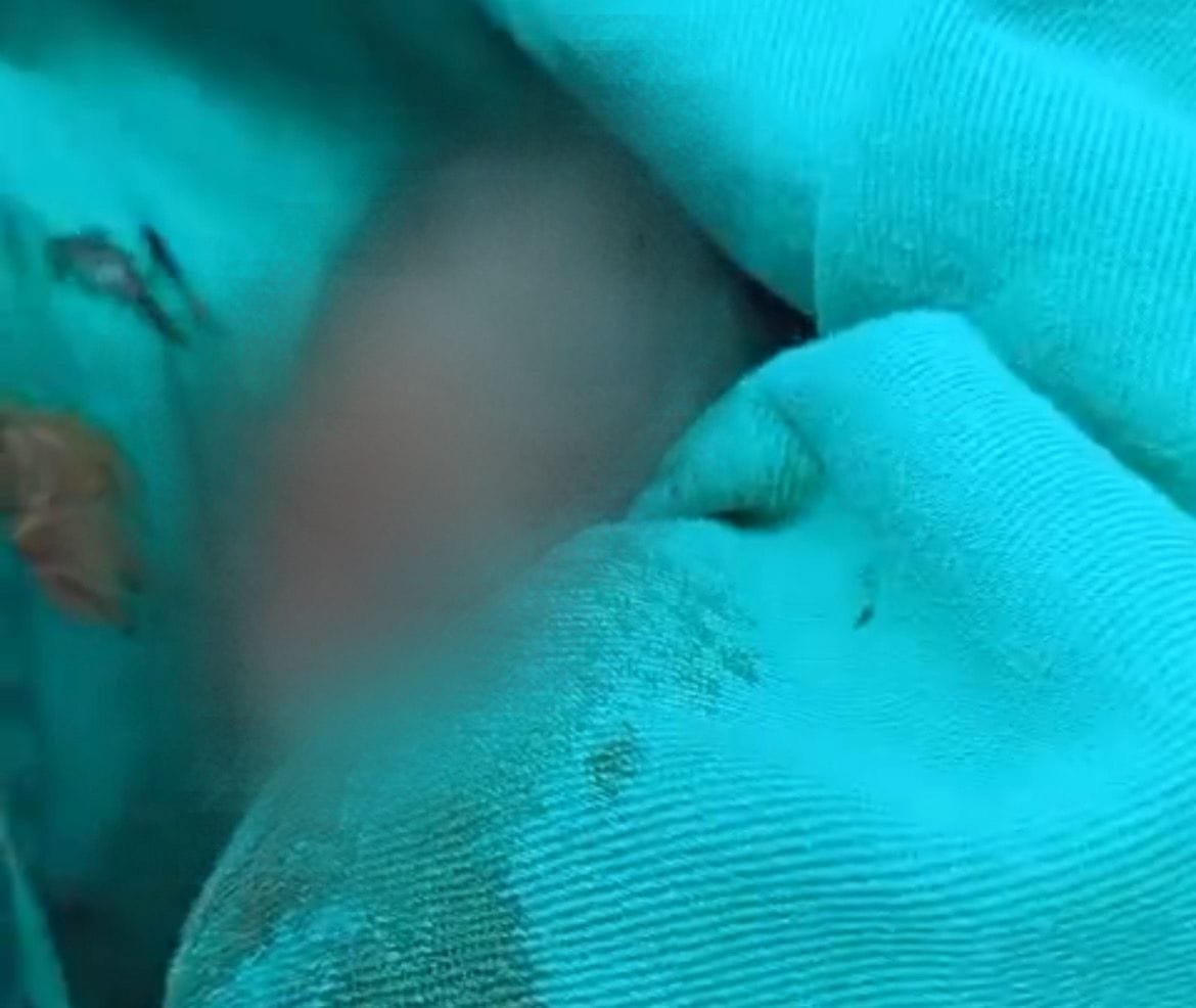 Bebê é declarado morto, ressuscita e acaba falecendo “outra vez”