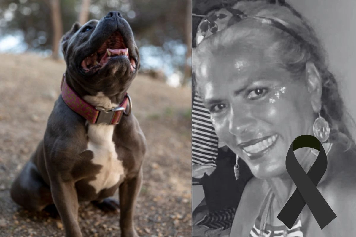 Depois de um mês internada, morre ex-chacrete atacada por pitbull