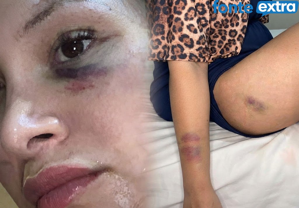 “Eu não queria morrer”: suspeita de matar empresário no Paraguai quebra o silêncio e alega legítima defesa