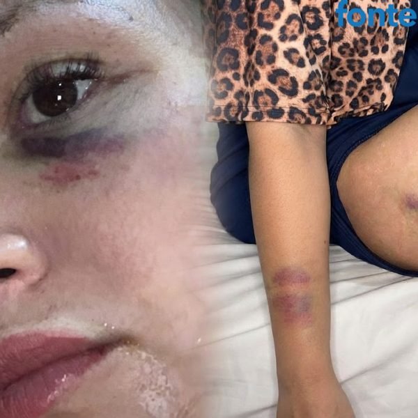 “Eu não queria morrer”: suspeita de matar empresário no Paraguai quebra o silêncio e alega legítima defesa